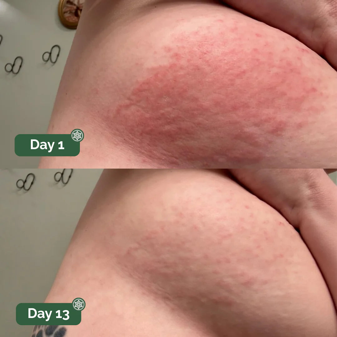 Velara Antifungal Soap