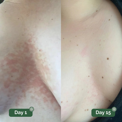 Velara Antifungal Soap