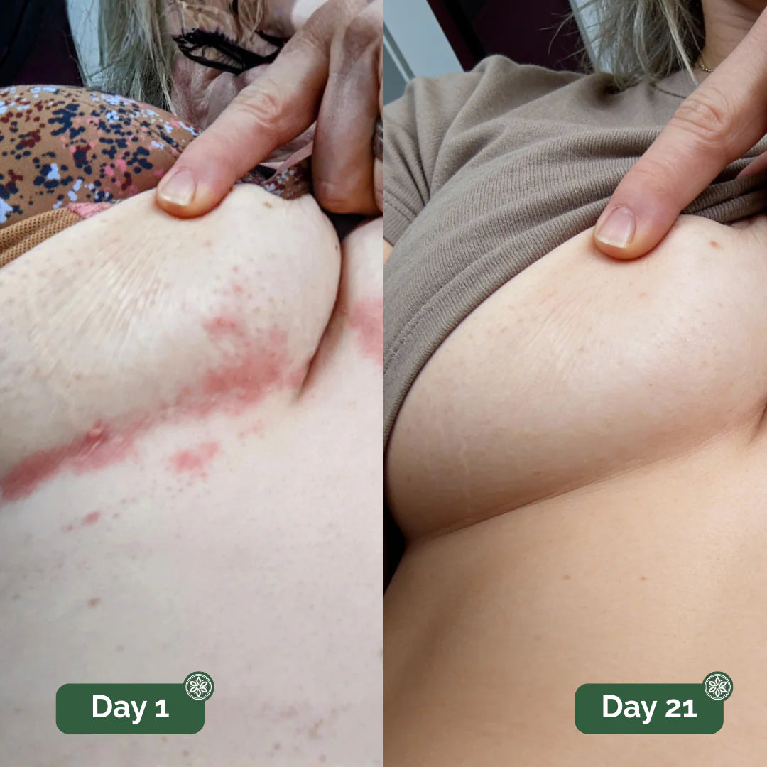 Velara Antifungal Soap